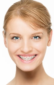 Woman smiling with braces after a orthodontics visit