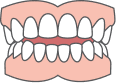 Clear aligners for open bite correction in Edmonton