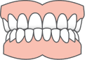 Clear aligners for underbite correction in Edmonton